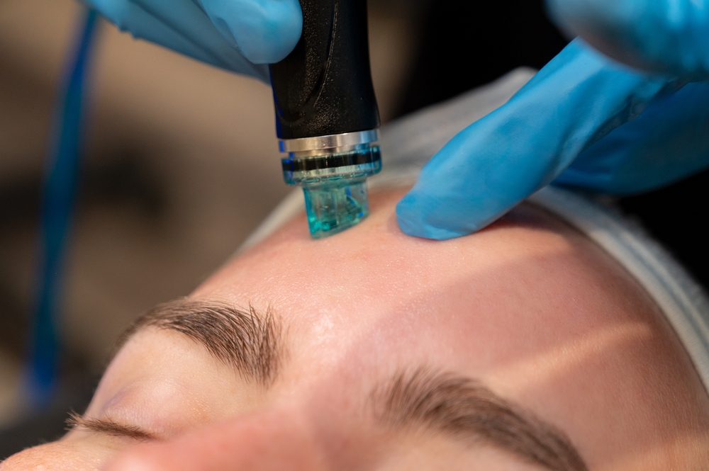 HydraFacial marie claire hrvatska