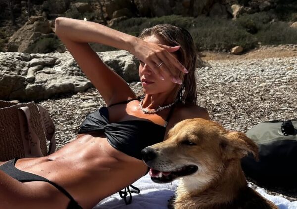 tamne mrlje na pazuhu marie claire hrvatska