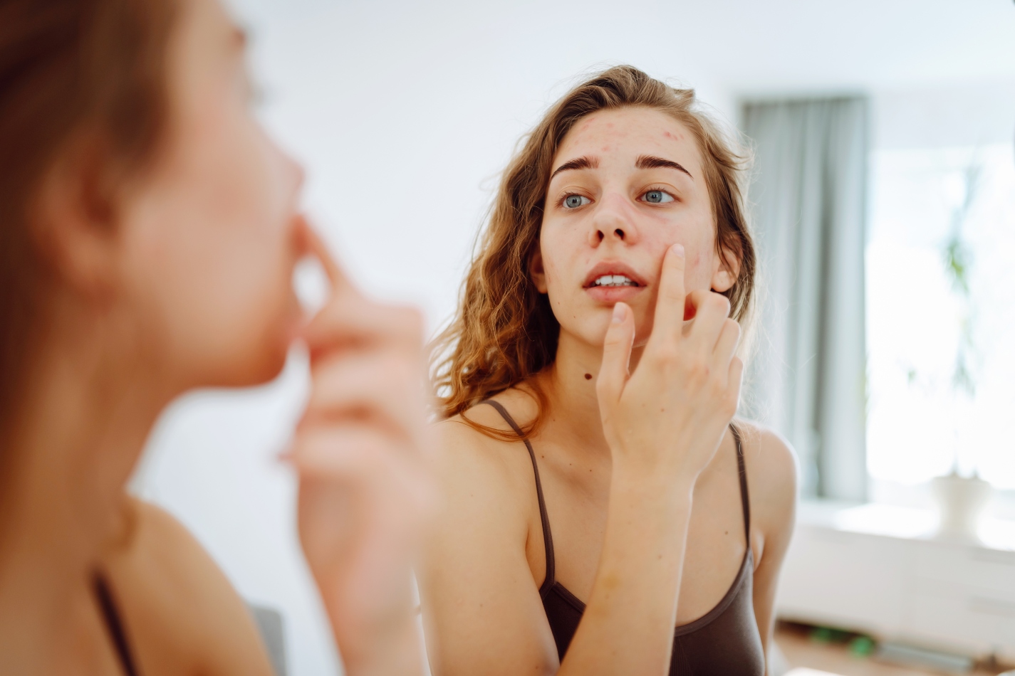 Akne u odrasloj dobi, Marie Claire Hrvatska